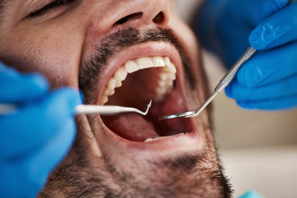 Best Dental Abscess Treatment in Richton Park, IL