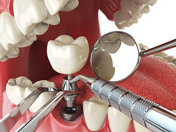 Best Emergency Cosmetic Dentistry (e.g., broken veneers) in Richton Park, IL